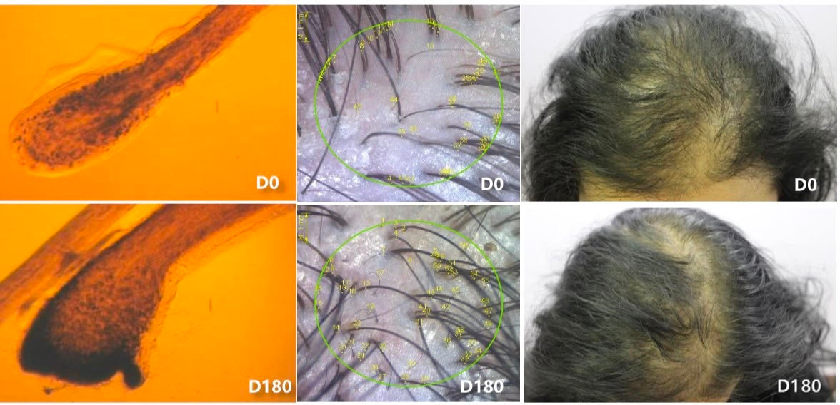 Hair Growth Plant Extract 植物萃取生髮因子 20ml - Discover Health & Lifestyle Asia