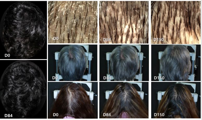 Phyllanthus Emblica Hair Darkening Extract余甘子白轉黑因子 20ml - Discover Health & Lifestyle Asia